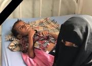 انتقاد یونیسف از بروز شرایط بحرانی انسانی در یمن