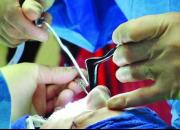 تبعات جراحی های زیبایی غیر قانونی در روزهای کرونایی