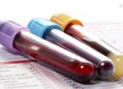 راستی آزمایی ادعاها درباره منشا ویروس کرونا