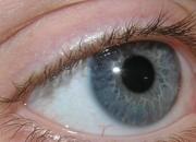 انحراف چشم کودکان چگونه درمان می‌شود؟