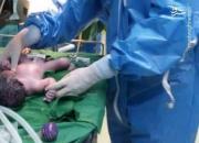 تولد نخستین نوزاد مبتلا به کرونا در مشهد