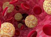 روش‌های درمان خانگی چربی خون بالا