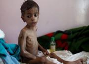 یمن بزرگترین کانون انتشار وباء در قرن بیست و یک است