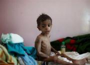  هشدار ۱۴ سازمان بین المللی درباره بحران انسانی یمن