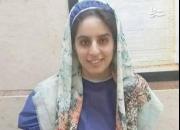 مرگ سحر دختر تهرانی پس از جراحی زیبایی +عکس