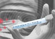 ثبت سه مورد مشکوک به ویروس کرونا در افغانستان