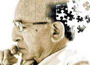 هشدار محققان: نشانه اولیه «آلزایمر» را بشناسید