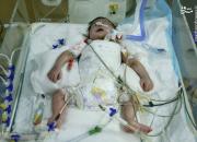 توضیحات وزارت بهداشت در خصوص عدم ترخیص نوزاد از یک بیمارستان