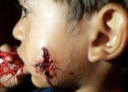 حمله سگ خانگی به کودک خردسال+ فیلم