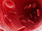 فاکتورهای پرخطر ابتلا به سرطان خون