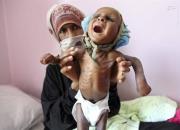 در ۱۷۰۰ روز جنگ، ۸۰۰ کودک یمنی معلول شدند