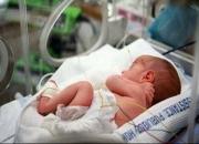 ضرورت آزمایش غربالگری نوزاد تا ۳ روز اول پس از تولد