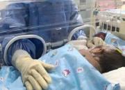 سختی کار پرستاران بخش نوزادان و کودکان