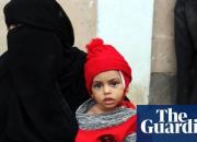 جان باختن ۸۵ هزار کودک یمنی در اثر گرسنگی