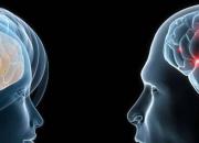 آیا مغز مردان از زنان بزرگتر است؟