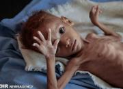 طوفان توییتری‌ها برای کودکان بی‌دفاع یمن