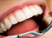 آیا پر کردن و ترمیم دندان روزه را باطل می‌کند؟