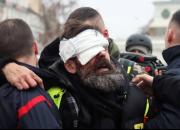 تیر «فلش بال» به چشم تظاهرکنندگان فرانسوی خورد اما رسانه‌ها و نهادهای بین‌المللی کور شدند/ از نابینایی تا قطع عضو؛ نتیجه تاکتیک‌های مرگبار پلیس پاریس! +عکس