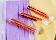 نتیجه بررسی چند دارو روی کرونا تا ظهر مشخص می‌شود