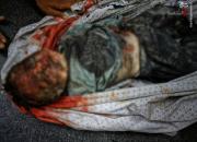 کودک‌کشی تکان دهنده رژیم صهیونیستی در غزه+ فیلم (۱۸+) ‏