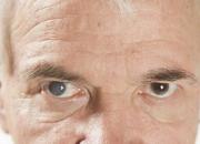 عوامل ابتلا به آب مروارید/درمان بموقع از نابینایی پیشگیری می‌کند