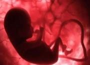 آیا آلودگی‌هوا بر جنسیت جنین در دوره بارداری تاثیر می‌گذارد؟