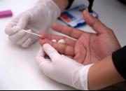 شناسایی مبتلایان به ویروس HIV در لردگان
