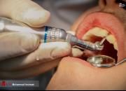 فیلم/ تعطیلی مطب‌های دندانپزشکی تا اطلاع ثانوی